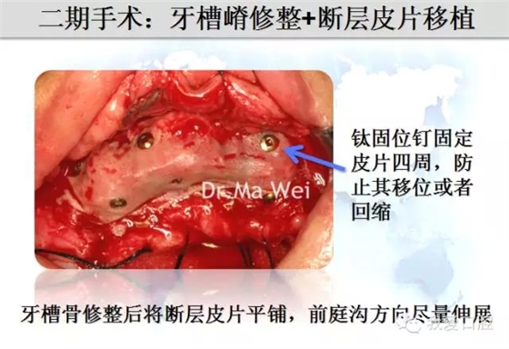 8.webp.jpg 8.webp.jpg