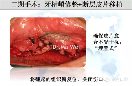 9.webp.jpg 9.webp.jpg