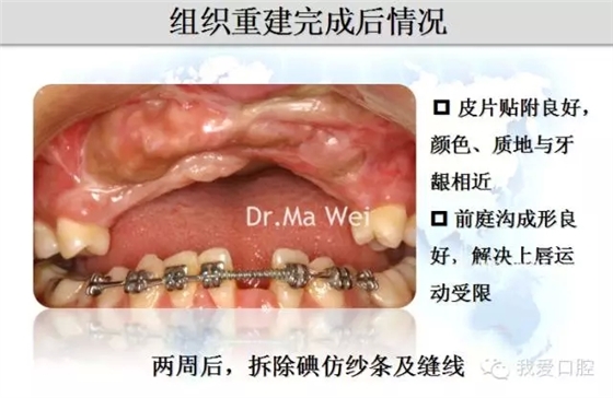 12.webp.jpg 12.webp.jpg