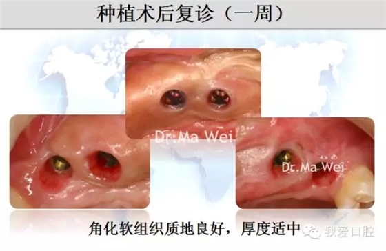 28.webp.jpg 28.webp.jpg