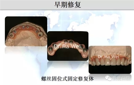 31.webp.jpg 31.webp.jpg