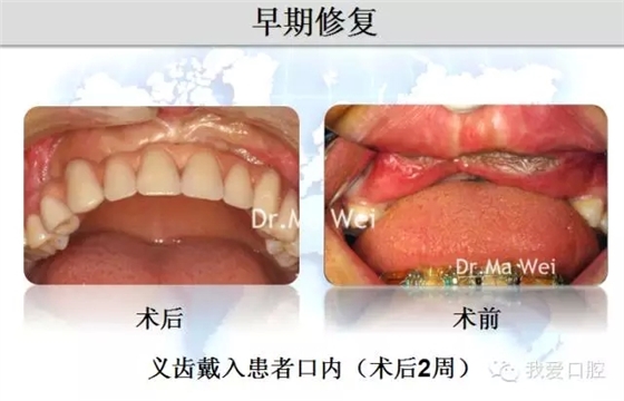 32.webp.jpg 32.webp.jpg