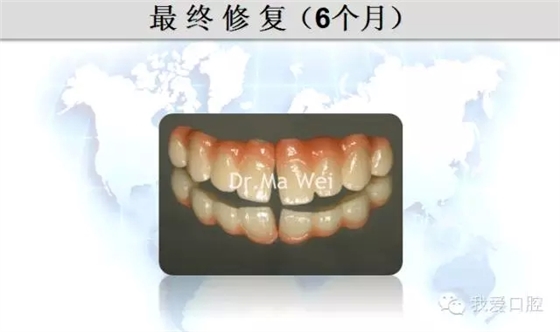 33.webp.jpg 33.webp.jpg