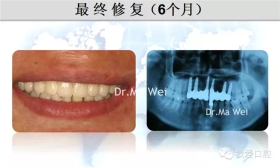 35.webp.jpg 35.webp.jpg