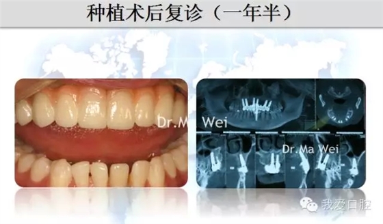 36.webp.jpg 36.webp.jpg