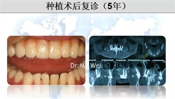 37.webp.jpg 37.webp.jpg