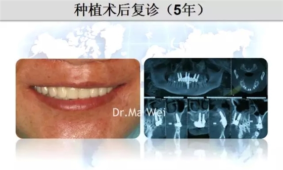 38.webp.jpg 38.webp.jpg