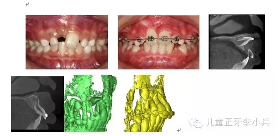 41.webp.jpg 41.webp.jpg