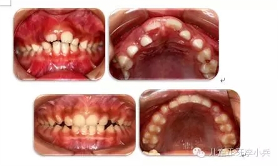 42.webp.jpg 42.webp.jpg