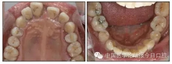 4.webp.jpg 4.webp.jpg