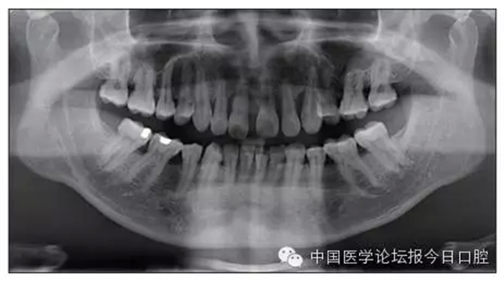 6.webp.jpg 6.webp.jpg