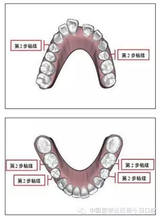 10.webp.jpg 10.webp.jpg