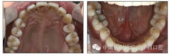 15.webp.jpg 15.webp.jpg