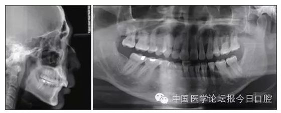 640.webp.jpg 640.webp.jpg