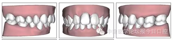 16.webp.jpg 16.webp.jpg