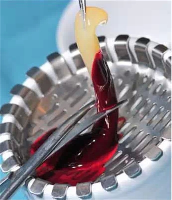 知道PRP?知道PRF?知道CGF? 知道PRP?知道PRF?知道CGF?