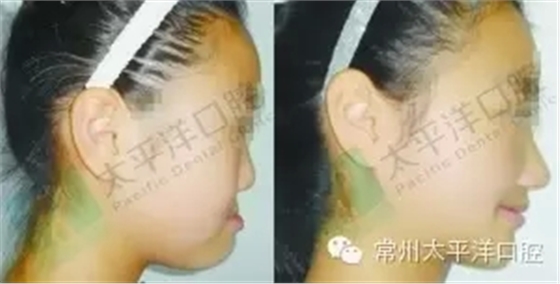 1.webp.jpg 1.webp.jpg