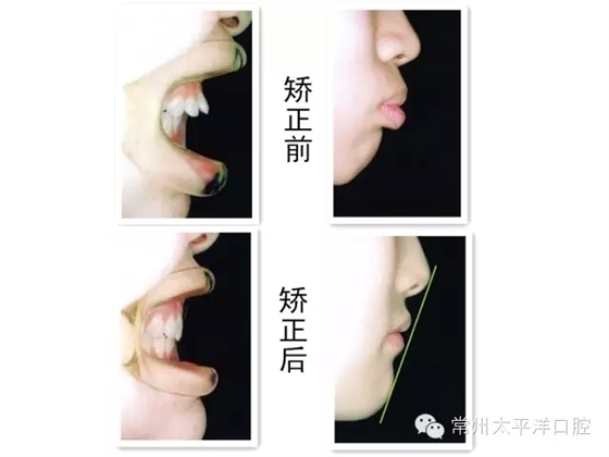 2.webp.jpg 2.webp.jpg