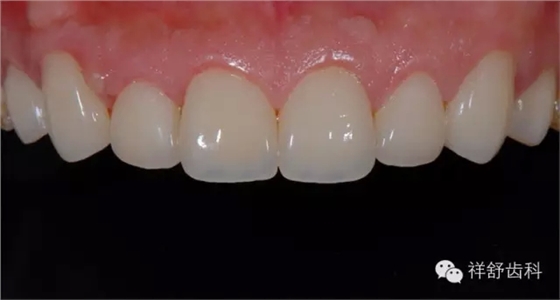 17.webp.jpg 17.webp.jpg