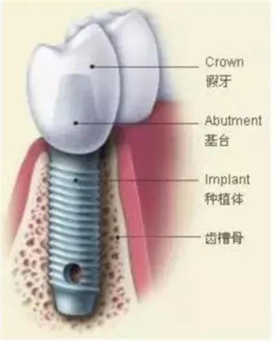 640.webp.jpg 640.webp.jpg