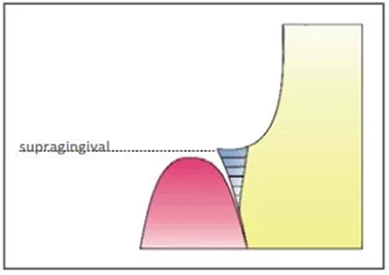 20.webp.jpg 20.webp.jpg