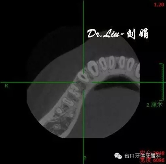 2.webp.jpg 2.webp.jpg