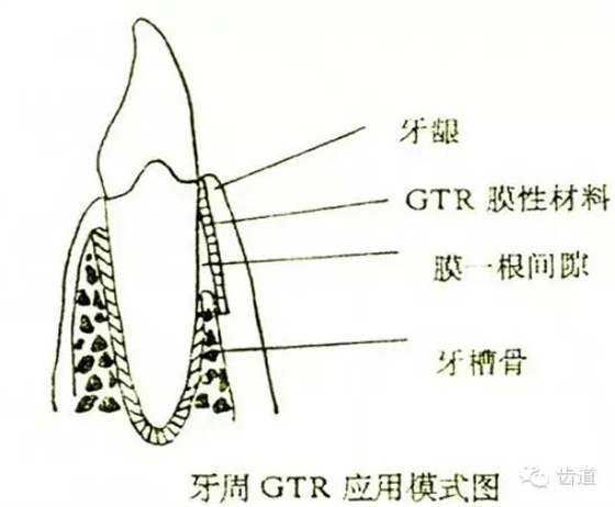 3.webp.jpg 3.webp.jpg