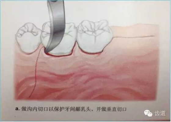 6.webp.jpg 6.webp.jpg