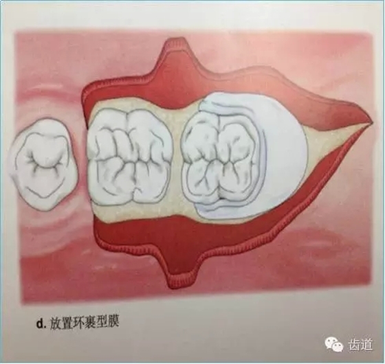 9.webp.jpg 9.webp.jpg