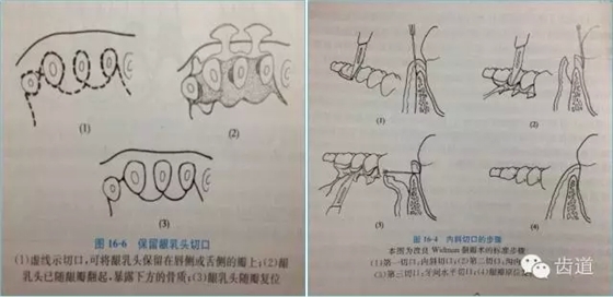 14.webp.jpg 14.webp.jpg