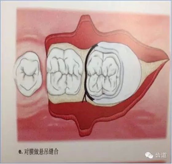 15.webp.jpg 15.webp.jpg