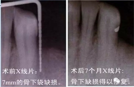 18.webp.jpg 18.webp.jpg