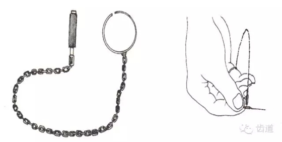 根管治療的并發(fā)癥及處理 根管治療的并發(fā)癥及處理