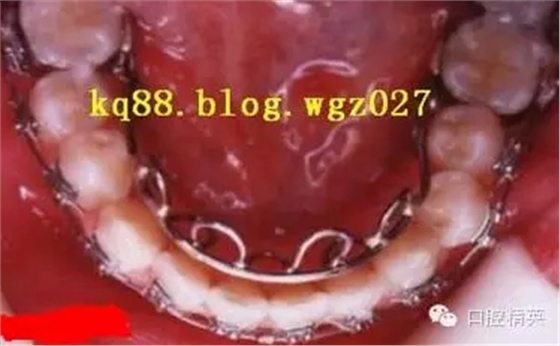 3.webp.jpg 3.webp.jpg