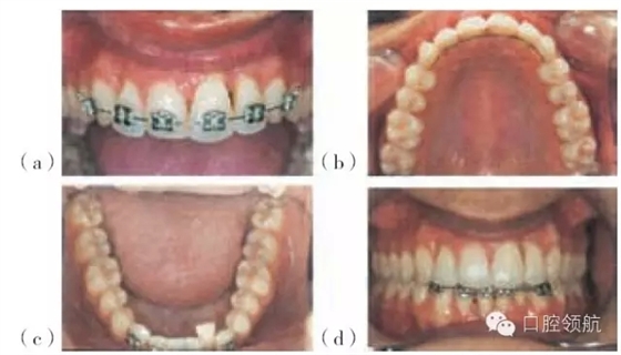 9.webp.jpg 9.webp.jpg