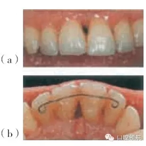 12.webp.jpg 12.webp.jpg