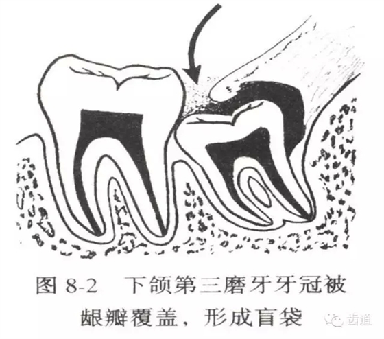 5.webp.jpg 5.webp.jpg