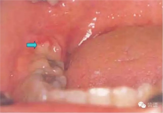 6.webp.jpg 6.webp.jpg