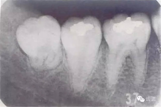 7.webp.jpg 7.webp.jpg