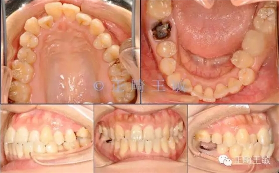 30.webp.jpg 30.webp.jpg