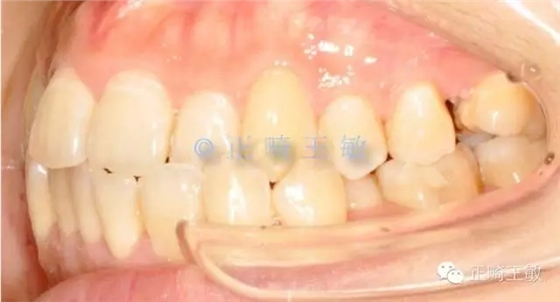 31.webp.jpg 31.webp.jpg