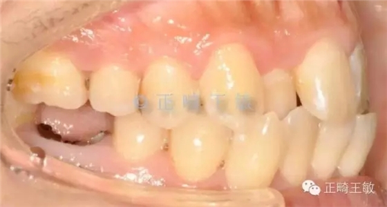 34.webp.jpg 34.webp.jpg