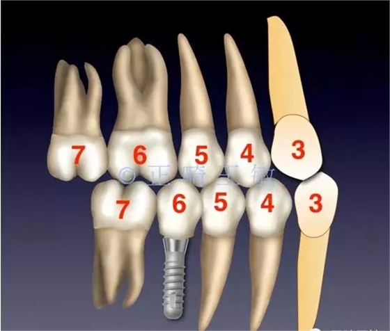 34.webp (1).jpg 34.webp (1).jpg