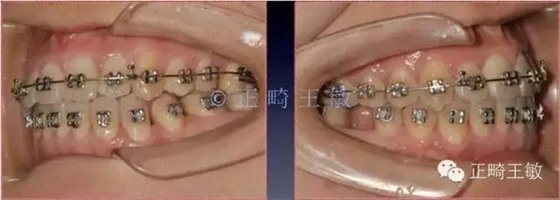 38.webp.jpg 38.webp.jpg