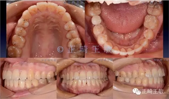 39.webp.jpg 39.webp.jpg