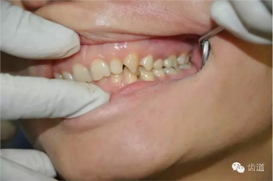 44.webp.jpg 44.webp.jpg