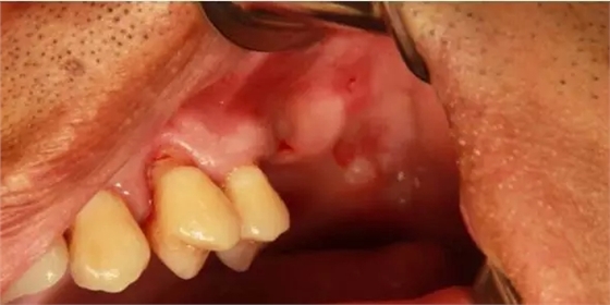 1.webp.jpg 1.webp.jpg