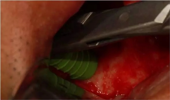 5.webp.jpg 5.webp.jpg