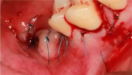 10.webp.jpg 10.webp.jpg