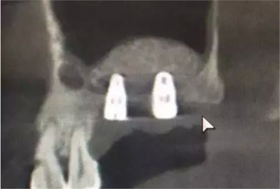 11.webp.jpg 11.webp.jpg